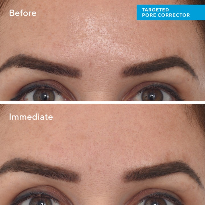 Murad Targeted Pore Corrector 15 ml porereduserende behandling før og etterbilde som viser umiddelbart jevnere hud