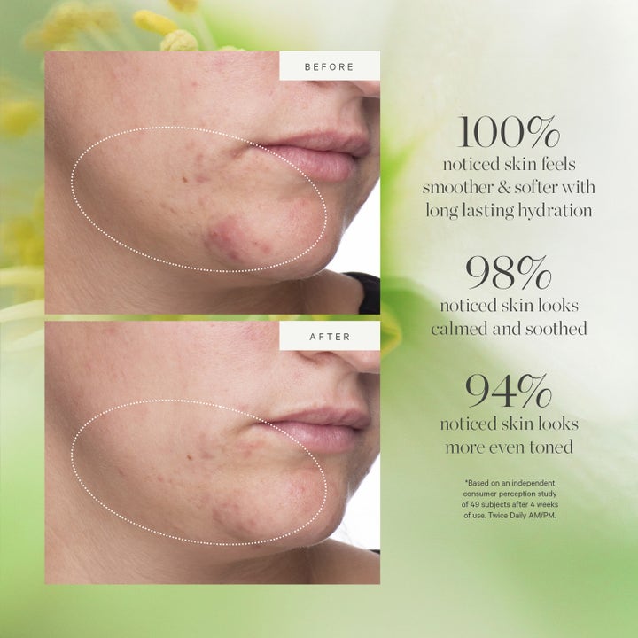 KORA Organics Active Algae Moisturizer 50 ml beroligende dagkrem med før- og etterbilder som viser jevnere hudtone.