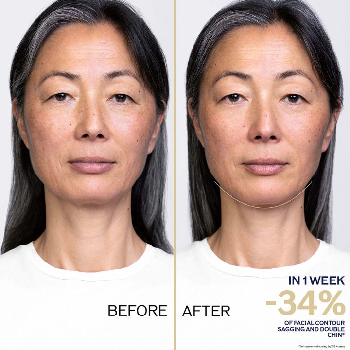 Shiseido Vital Perfection Overnight Firming Treatment 80 ml nattbehandling med før- og etterbilde etter en uke.