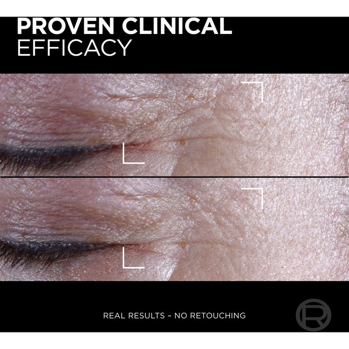 L'Oréal Paris Age Perfect Cell Renewal Midnight Eye Cream 15 ml øyekrem viser klinisk dokumentert effekt på rynker