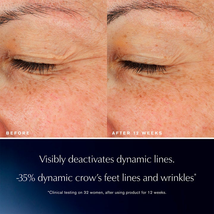 Estée Lauder Advanced Night Repair Eye Lift + Sculpt 15 ml øyeserum reduserer rynker og kråketær etter tolv uker