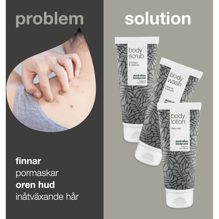 Australian Bodycare 3 Body Products 100 ml mot kviser og uren hud viser kvisete rygg og tre tuber med grått bladmotiv