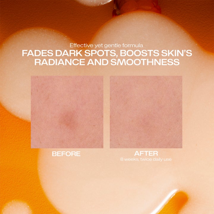 Lumene Dark Spot Serum 30 ml serum som gir glød og reduserer mørke flekker vist med før og etter bilder