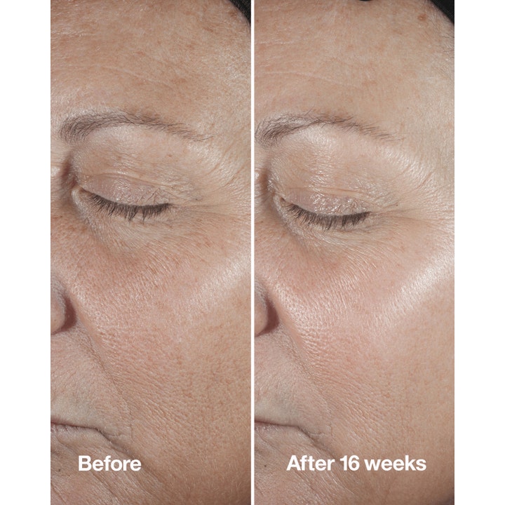 Clinique Smart Clinical Repair Wrinkle Correcting Serum 50 ml rynkeserum viser synlig effekt før og etter 16 uker.