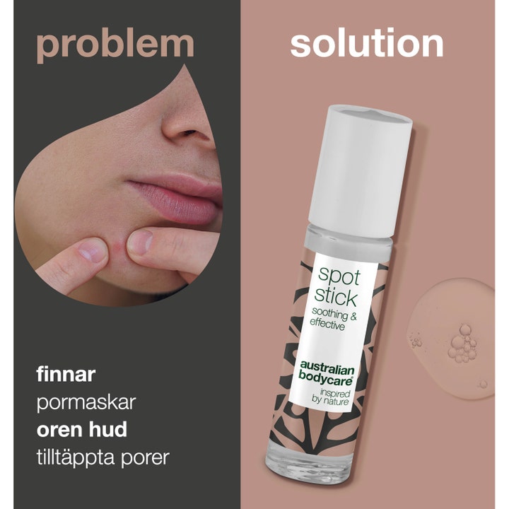 Australian Bodycare Spot Stick 9 ml mot uren hud i roll-on glassflaske vist som løsning på kviser og hudormer.
