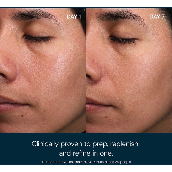 Elemis Pro-Collagen Toning Mist 150 ml ansiktsvann før og etter bilde som gir en jevnere hudtone
