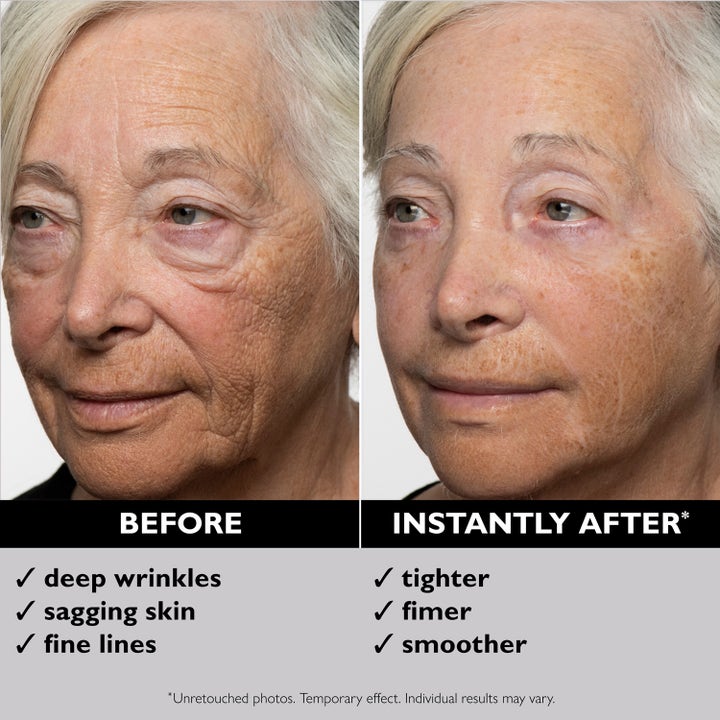 Peter Thomas Roth Instant FIRMx 100 ml oppstrammende serum før og etter bilde som viser glattere hud.