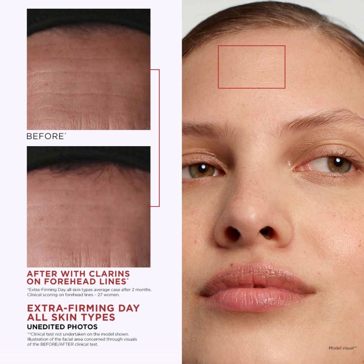 Clarins Extra-Firming Nuit 50 ml nattkrem viser før og etter resultat med synlig glattere hud i pannen.