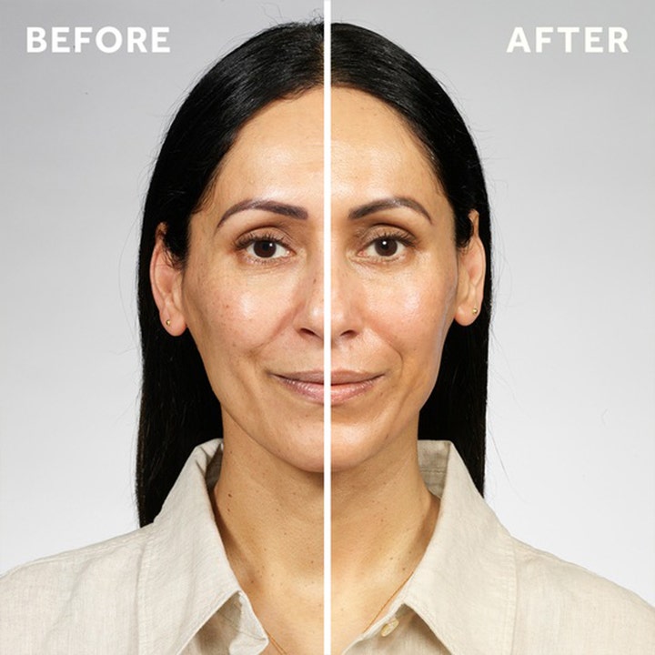 No7 Pure Retinol Triple Action Day Cream 100 ml viser før og etter resultat på kvinneansikt