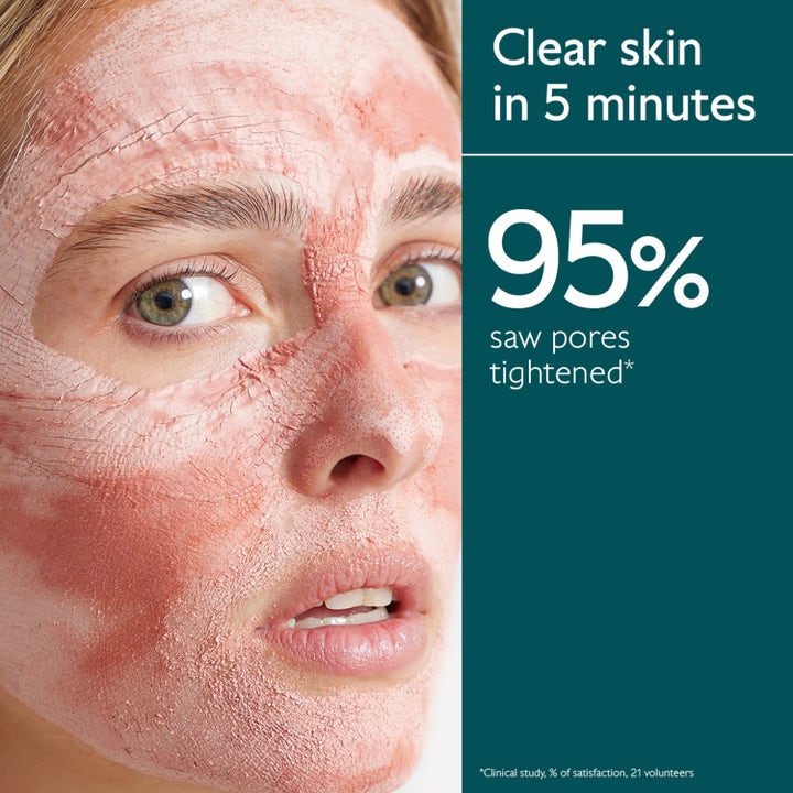 Caudalie Instant Detox Mask 35 ml ansiktsmaske påført i ansiktet for mindre porer og renere hud