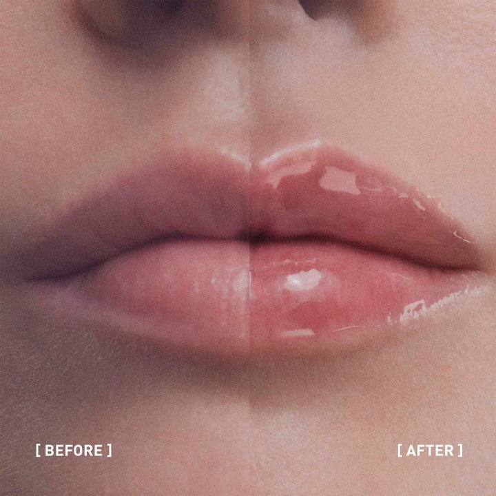 Hyalu-Filler Lips
