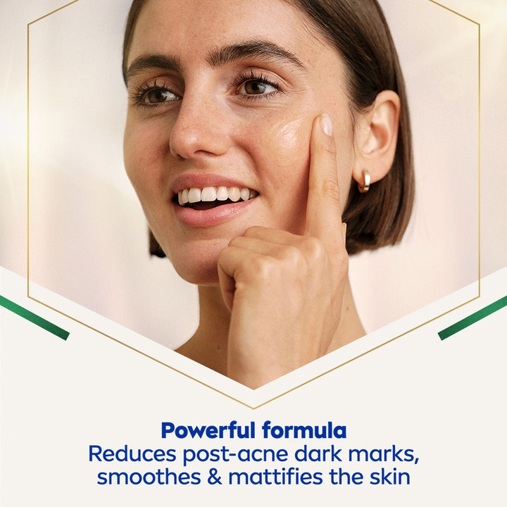 NIVEA LUMINOUS 630 Post-Acne Marks Serum 30 ml reduserer merker etter akne vist på kvinne som påfører serumet.