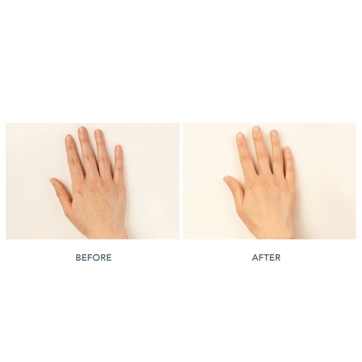FAQ Swiss FAQ 221 LED Hand Mask 1 stk hudpleie før og etter bilde som viser jevnere hudtone på hendene