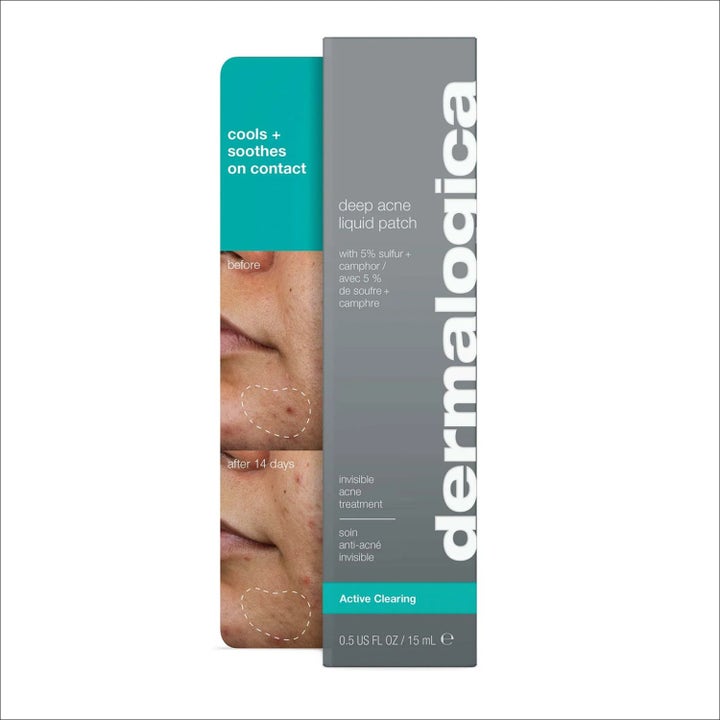 Dermalogica Deep Acne Liquid Patch Duo 2x15 ml kvisebehandling med før og etter bilder av hud