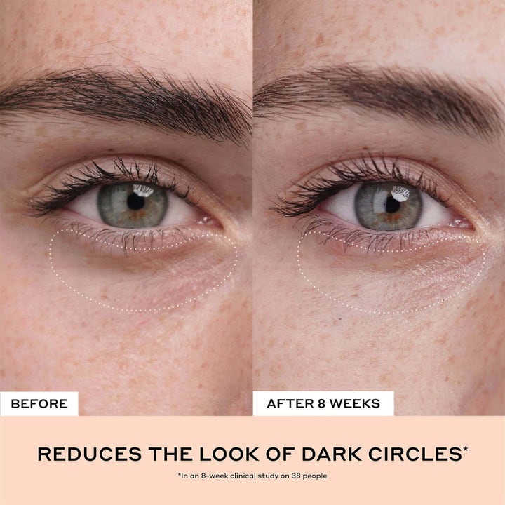 Ole Henriksen Truth Banana Bright + Eye Crème 15 ml øyekrem viser før og etter bilde av reduserte mørke ringer