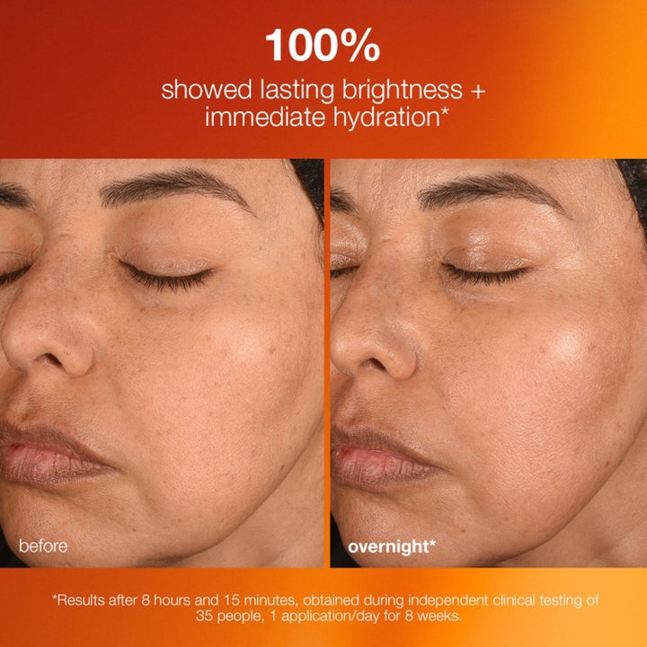Dermalogica Biolumin-C Night Restore Duo før og etter bilde som viser mer glød og umiddelbar fuktighet.