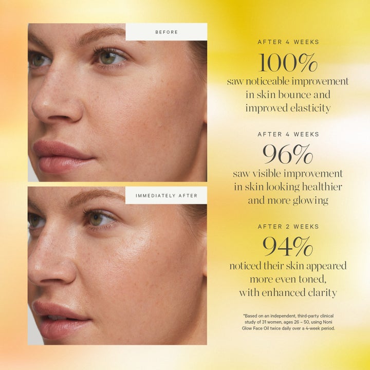 KORA Organics Noni Glow Face Oil 30 ml ansiktsolje før og etter bilder som viser økt glød og elastisitet