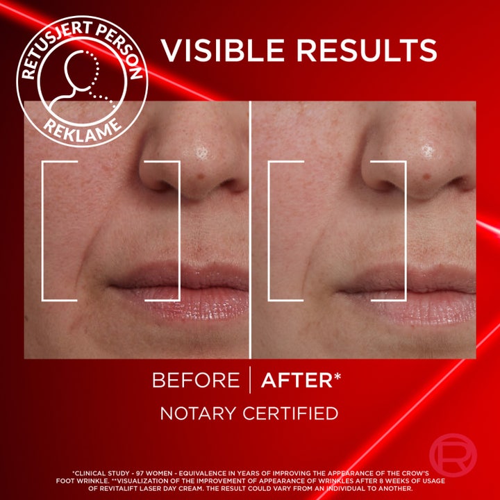 L'Oréal Paris Laser Advance Anti-Ageing Care Day 50 ml dagkrem gir fastere hud og klinisk beviste resultater