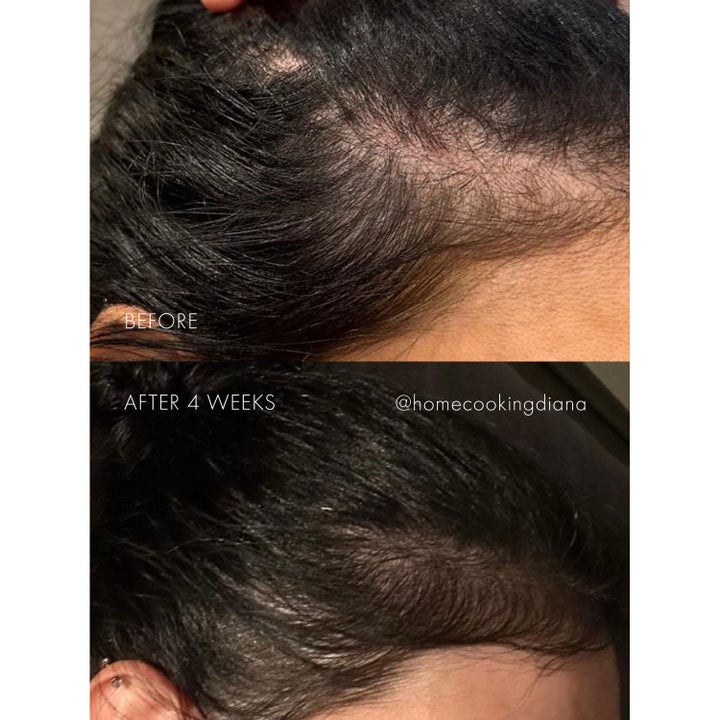 The Hair Serum