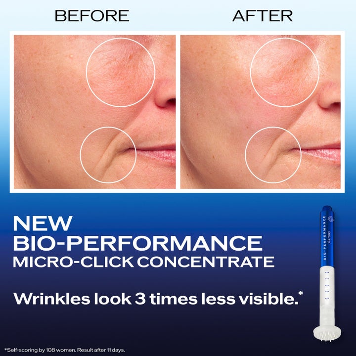 Shiseido Bio Performance Micro-Click 1,4 ml spot treatment reduserer rynker vist med før- og etterbilder.