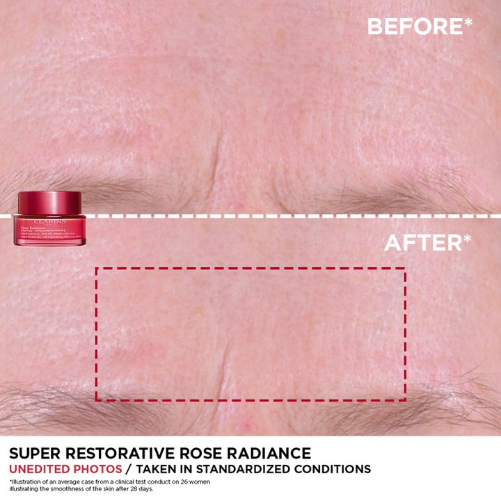 Clarins Rose Radiance Super Restorative 50 ml utglattende dagkrem viser før og etter resultat på rynker i pannen.