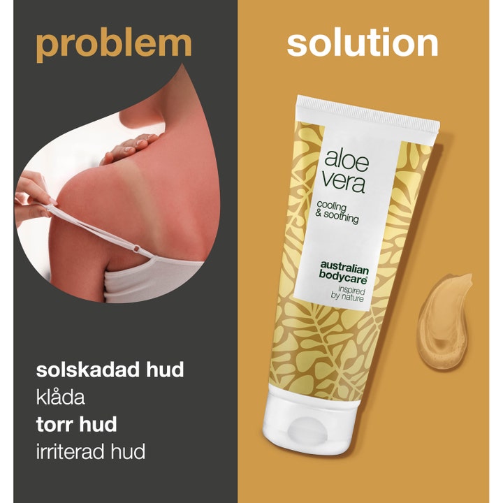 Australian Bodycare Aloe Vera Gel 100 ml beroligende gel mot solbrent hud vist ved siden av en solskadet skulder