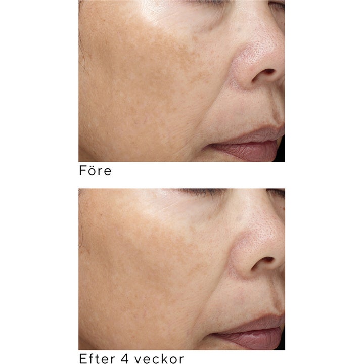 Murad Essential-C Firming Radiance Day Cream 50 ml dagkrem reduserer pigmentflekker vist med før og etter bilder.