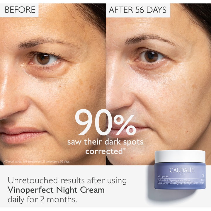 Caudalie Vinoperfect Dark Spot Correcting Night Cream 50 ml nattkrem før og etter bruk mot pigmentflekker
