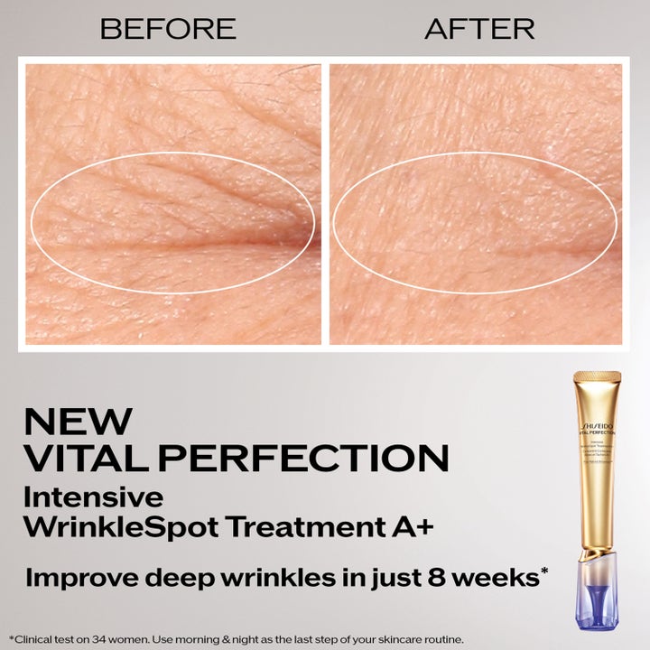 Shiseido Vital Perfection Intensive Wrinklespot Treatment A+ 20 ml rynkebehandling viser før og etter resultat på dype rynker