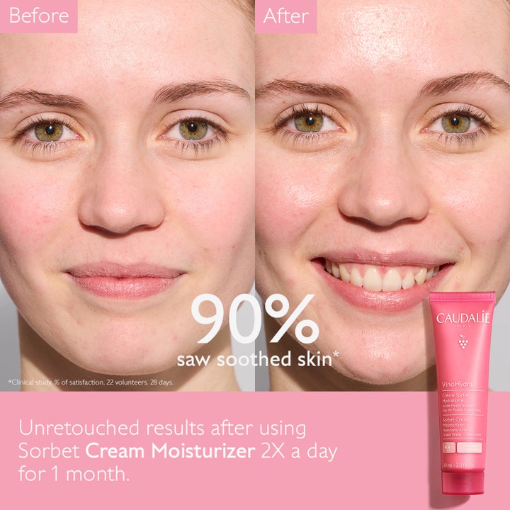 Caudalie Vinohydra Sorbet Cream 60 ml før og etter bruk som gir synlig beroliget hud i rosa tube.