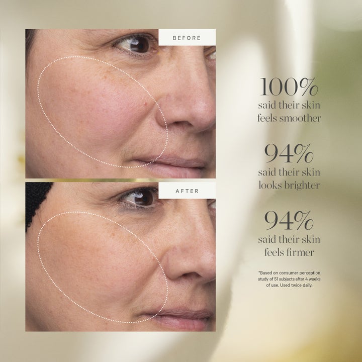 KORA Organics Turmeric Glow Moisturizer 50 ml ansiktskrem viser før- og etterbilder av synlig fastere og lysere hud