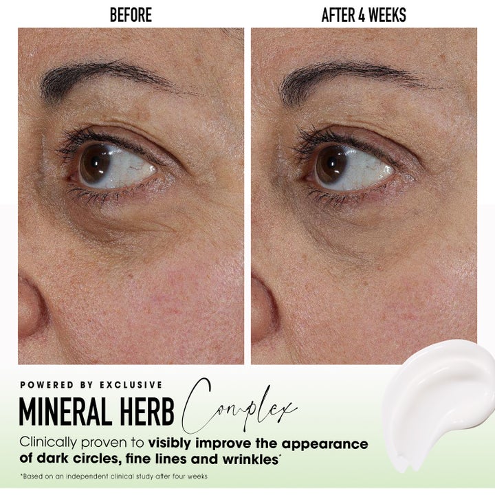 bareMinerals Skinlongevity Revitalizing Eye cream 15 g øyekrem viser før og etter resultat på mørke ringer og rynker