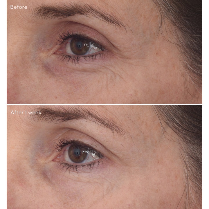 Murad Retinal ReSculpt Eye Lift Treatment 15 ml øyekrem før og etter resultat på rynker etter en uke