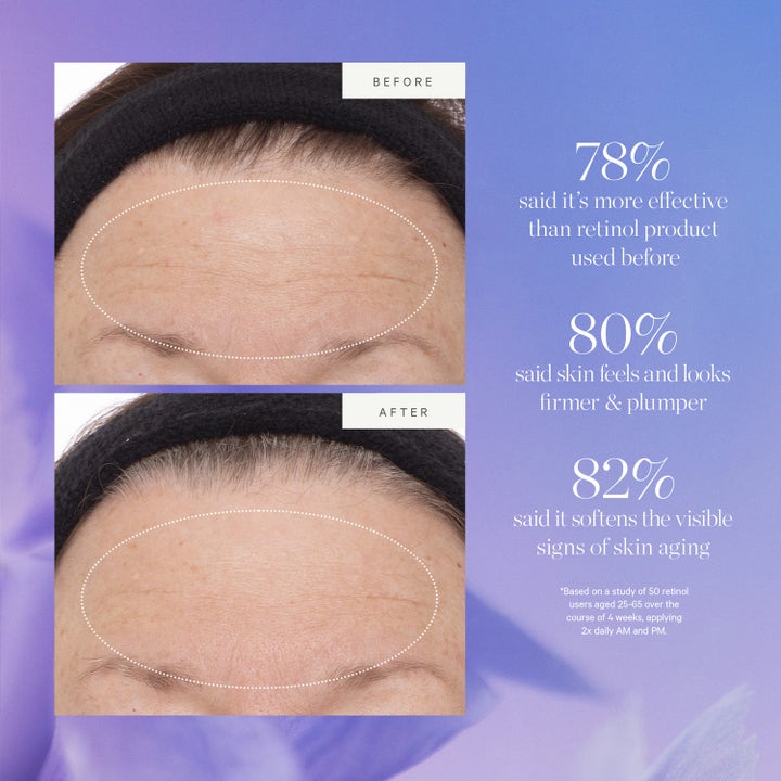 KORA Organics Plant Stem Cell Retinol Alternative Serum 30 ml før og etter bilder som viser glattere hud.