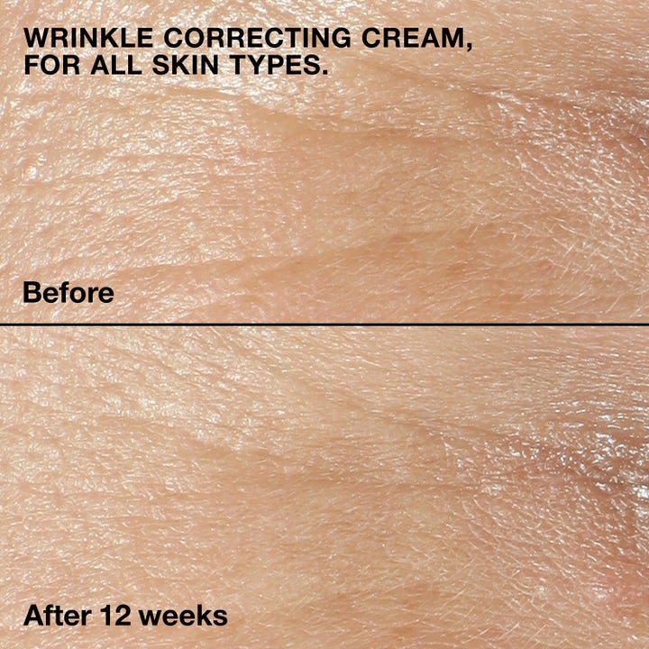 Clinique Smart Clinical Repair 65 ml rynkekrem før og etter bilder som viser glattere hud etter 12 uker