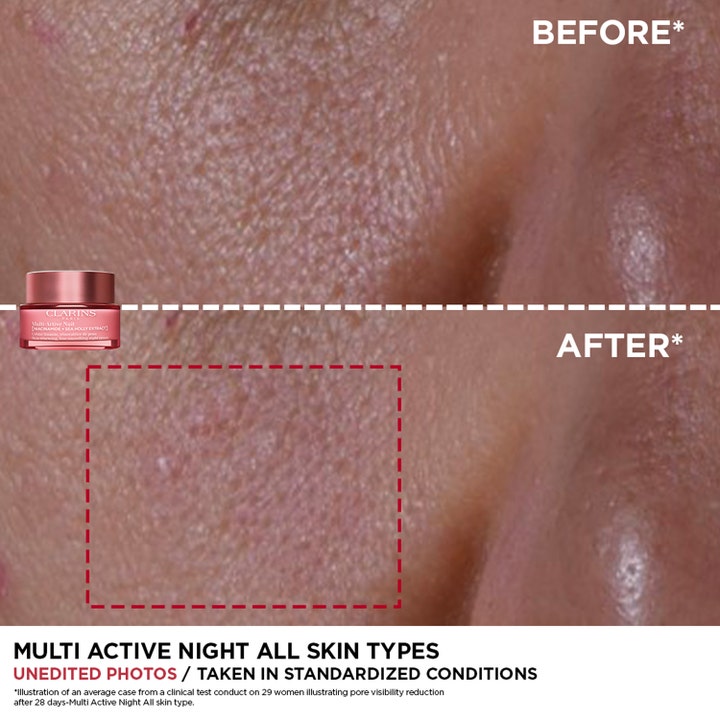 Clarins Multi-Active Nuit 50 ml nattkrem gir glattere hud og mindre porer vist i et uredigert før- og etterbilde.