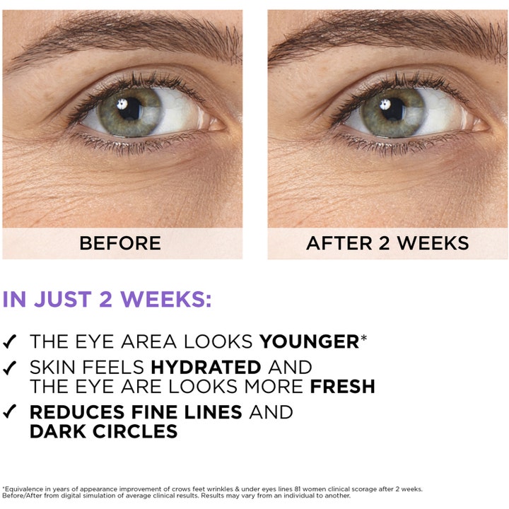 L'Oréal Paris Filler Eye Serum 20 ml øyeserum mot mørke ringer viser før og etter bilder med glattere hud etter to uker