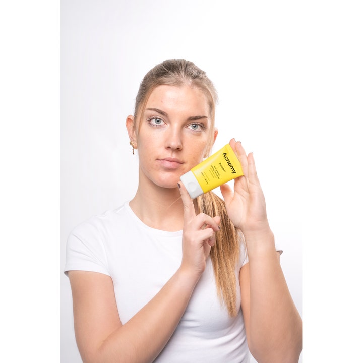 Niche Beauty Lab Acnemy Zitcalm 50 ml beroligende fuktighetskrem i gul tube som holdes av en kvinne.