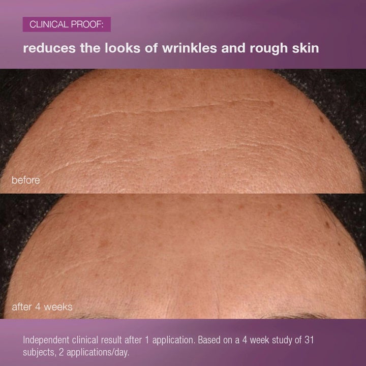 Dermalogica MultiVitamin Power Recovery Cream før og etter resultat på rynker og ujevn hud