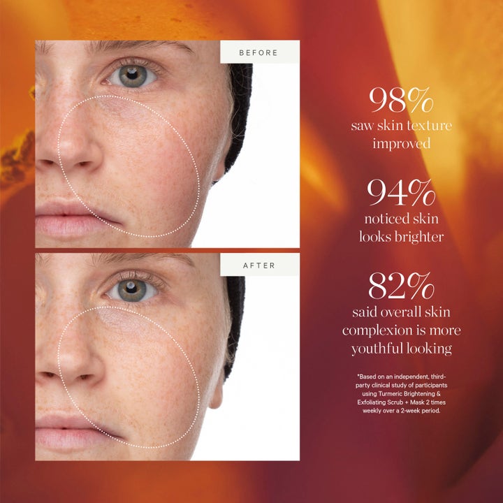 KORA Organics Turmeric Brightening Scrub & Mask 100 ml før og etter bilder som viser jevnere og klarere hudtone.