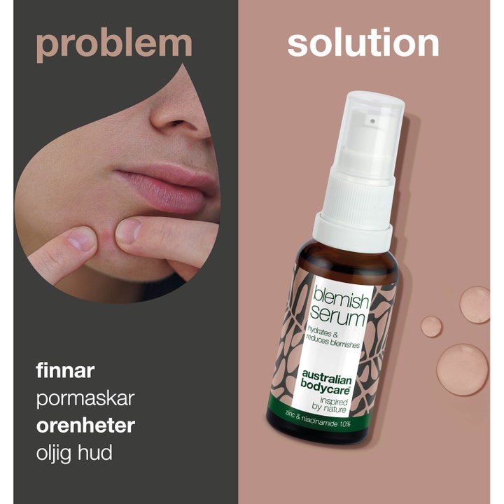 Australian Bodycare Blemish Serum 30 ml mot kviser og uren hud i glassflaske med pumpe