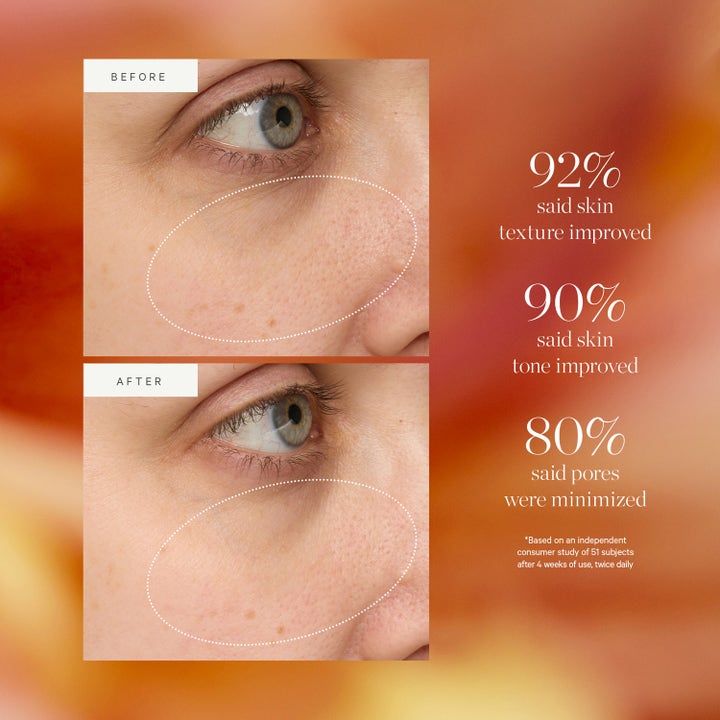 KORA Organics Turmeric Glow Drops 30 ml serum viser forbedret hudtekstur og minimerte porer på før og etter bilde