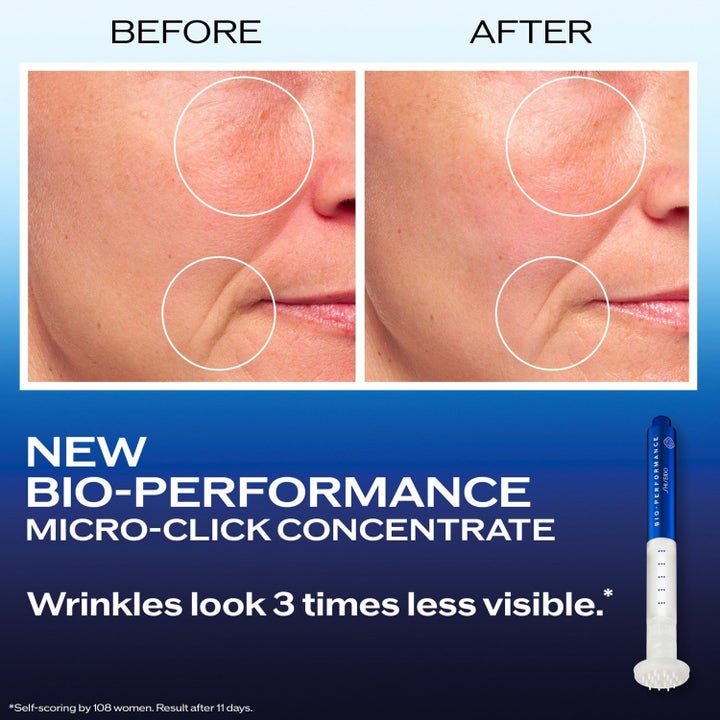 Shiseido Bio-Performance Micro-Click Concentrate 16,4 ml mot rynker med før- og etterbilde og blå klikkpenn