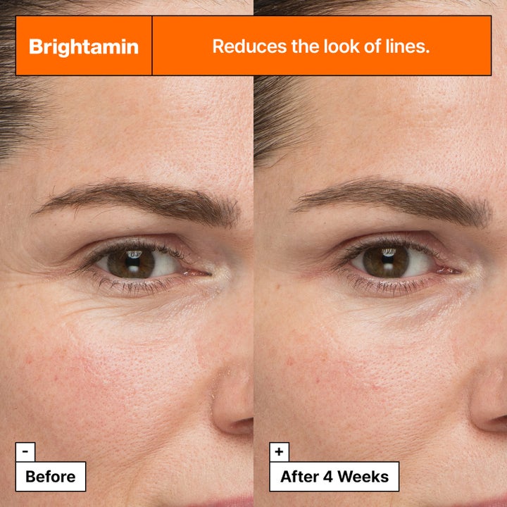 Dr.Jart+ Brightamin Brightening Serum Ampoule 8,08 g lysnende serum reduserer linjer vist med før- og etterbilder.