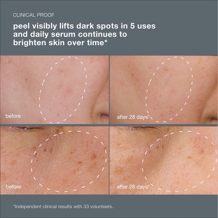 Dermalogica PowerBright Dark Spot System viser kliniske resultater på mørke flekker med før- og etterbilder.