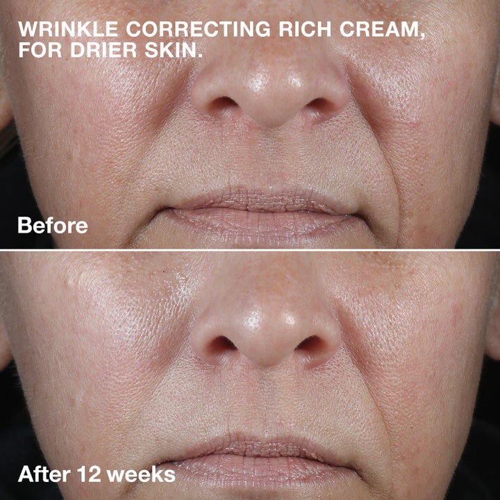 Clinique Smart Clinical Repair Wrinkle Face Cream Rich 50 ml rynkekorrigerende dagkrem før og etter 12 uker