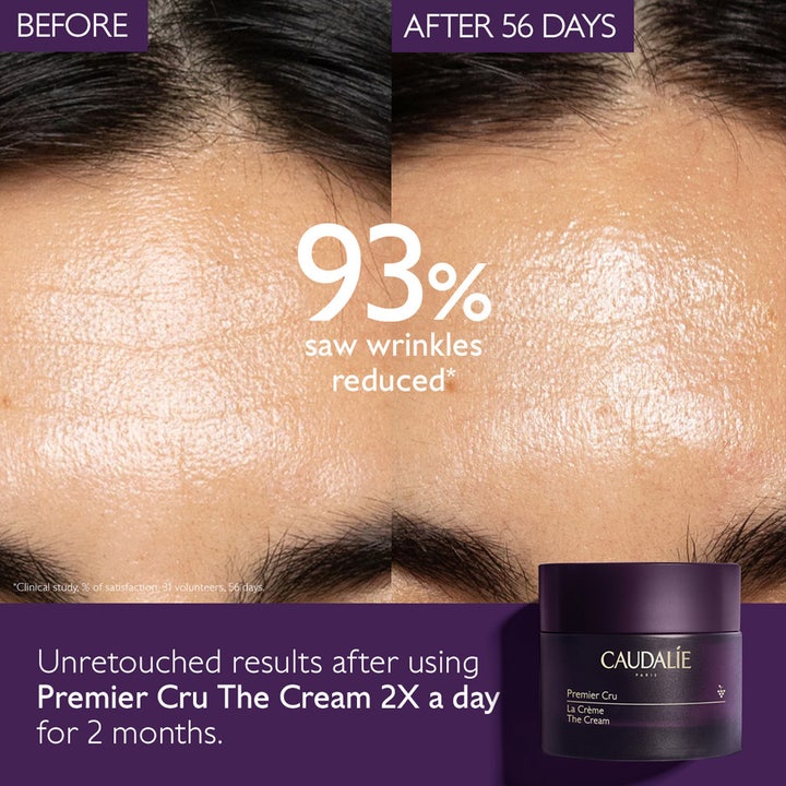 Caudalie Premier Cru The Cream 50 ml ansiktskrem reduserer rynker vist med før og etter-bilder av en panne.