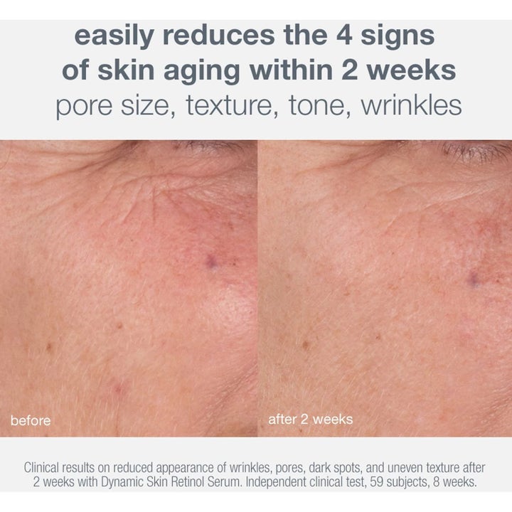 Dermalogica Skin Aging Solutions Duo hudpleiesett før og etter bilde som viser reduserte rynker og porer.