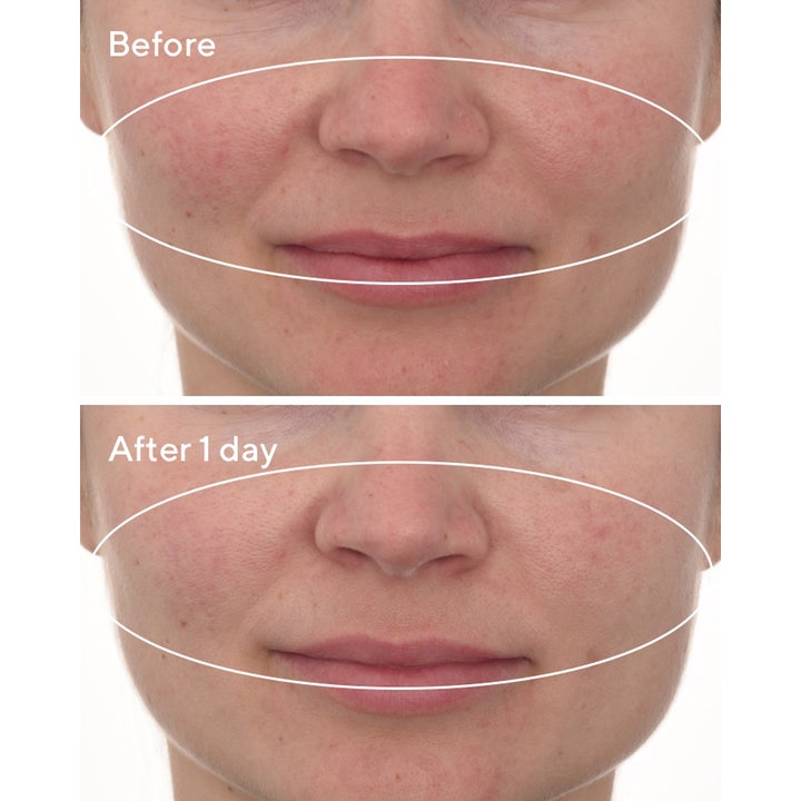 Murad Cellular Hydration Repair Mask 80 ml ansiktsmask før og etter bruk som beroliger rødhet i huden