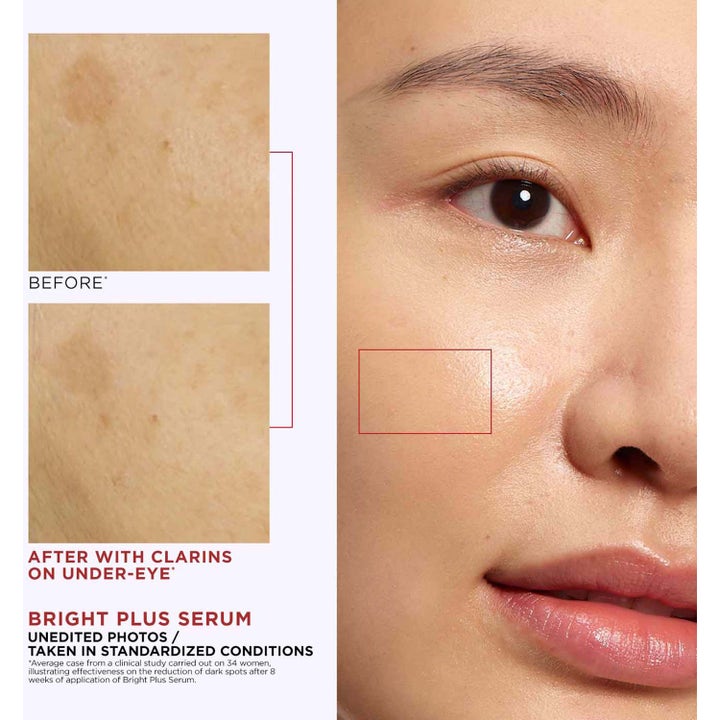 Clarins Bright Plus Advanced Expert Serum 30 ml viser før- og etterbilder med færre mørke flekker under øynene.